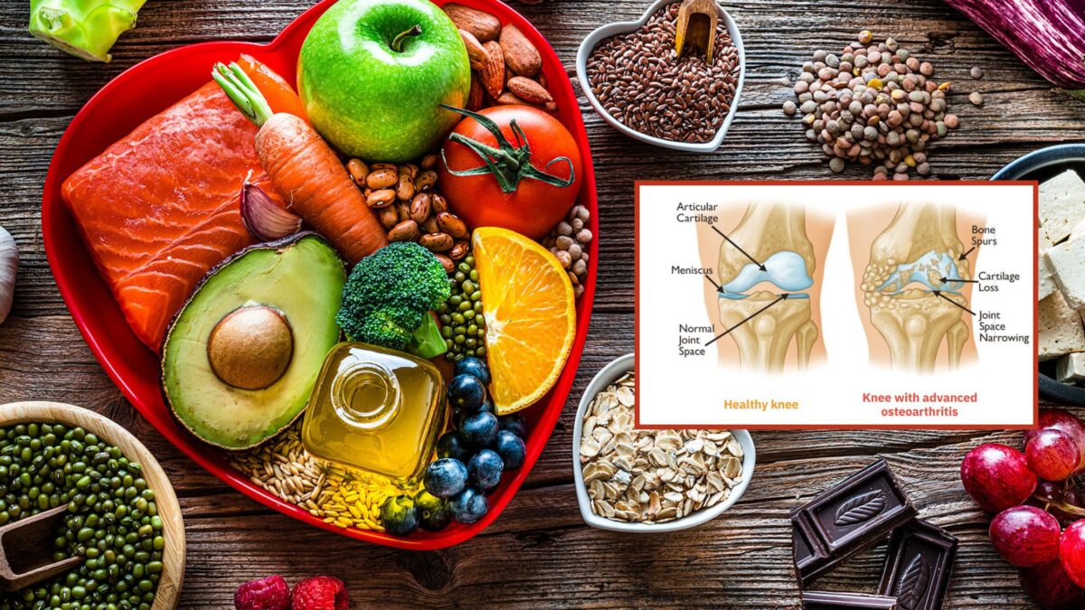 Food which prevents Osteoarthritis