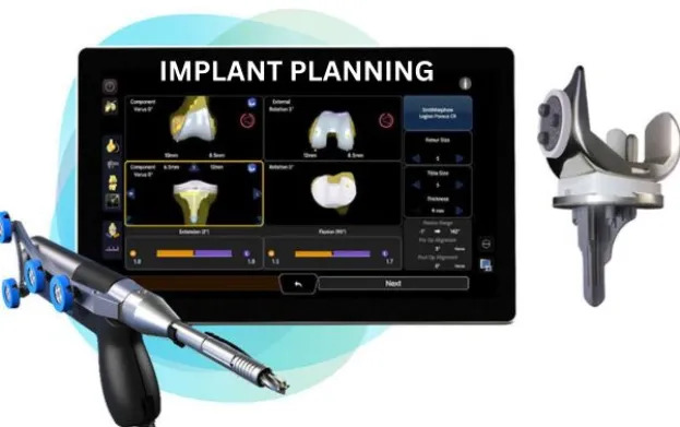 High-Precision Hip Replacement Surgery