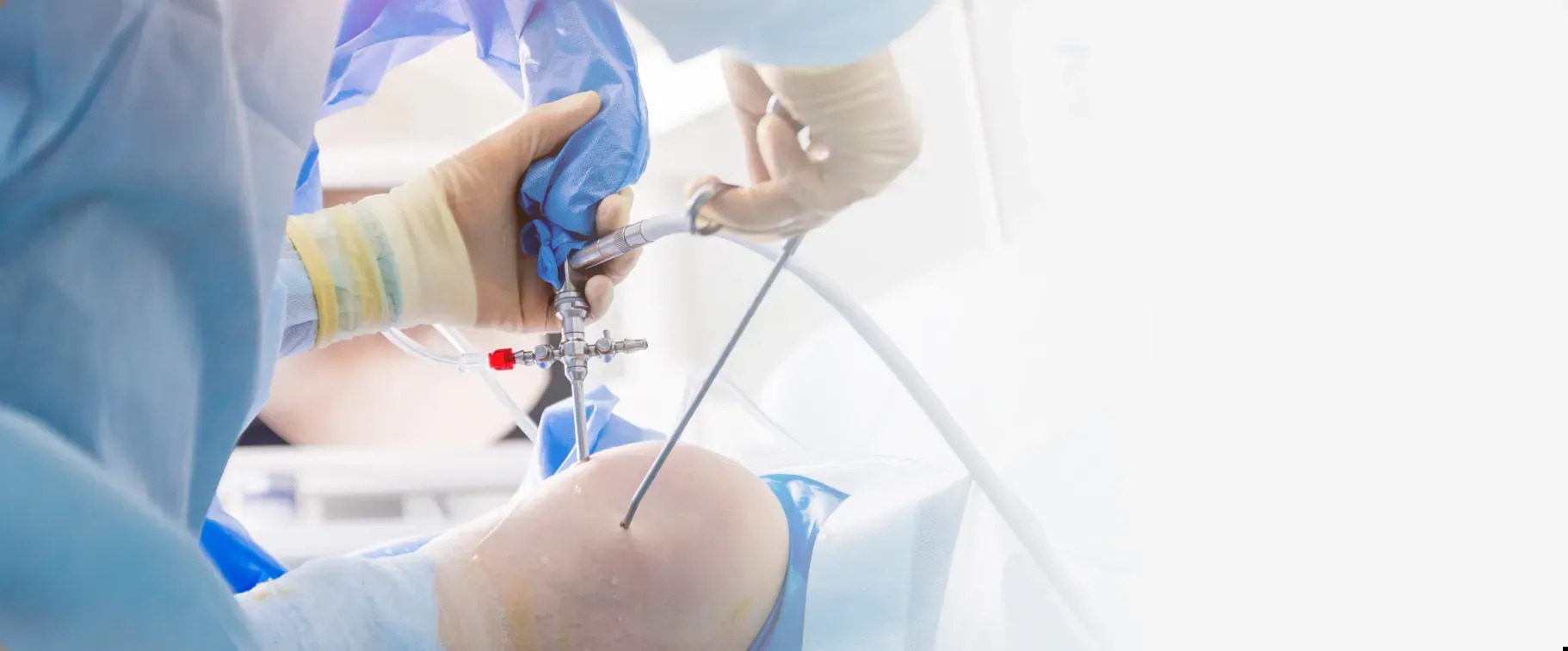 Choosing an Arthroscopy Specialist in Jaipur