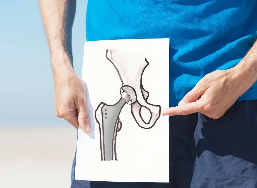 Reasons for hip replacement surgery